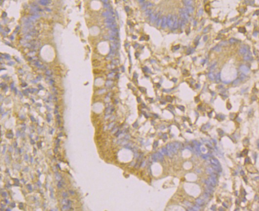 Immunohistochemical analysis of paraffin-embedded human small intestine tissue using anti-Osteoprotegerin antibody. Counter stained with hematoxylin.