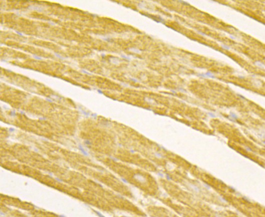 Immunohistochemical analysis of paraffin-embedded mouse heart tissue using anti-Osteoprotegerin antibody. Counter stained with hematoxylin.