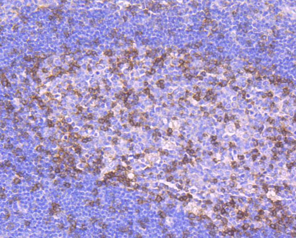 Immunohistochemical analysis of paraffin-embedded human tonsil tissue using anti-PD1 antibody. Counter stained with hematoxylin.