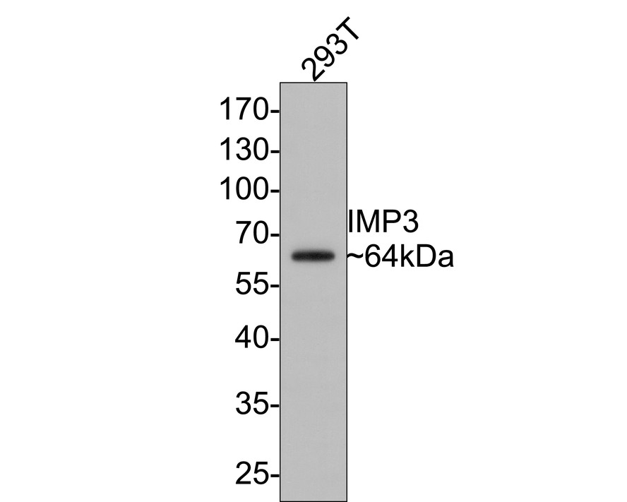 Western blot analysis of IMP3 on 293T cell lysates with Mouse anti-IMP3 antibody (EM1801-01) at 1/2,000 dilution.<br />
<br />
Lysates/proteins at 10 µg/Lane.<br />
<br />
Predicted band size: 64 kDa<br />
Observed band size: 64 kDa<br />
<br />
Exposure time: 30 seconds;<br />
<br />
10% SDS-PAGE gel.<br />
<br />
Proteins were transferred to a PVDF membrane and blocked with 5% NFDM/TBST for 1 hour at room temperature. The primary antibody (EM1801-01) at 1/2,000 dilution was used in 5% NFDM/TBST at room temperature for 2 hours. Goat Anti-Mouse IgG - HRP Secondary Antibody (HA1006) at 1:100,000 dilution was used for 1 hour at room temperature.