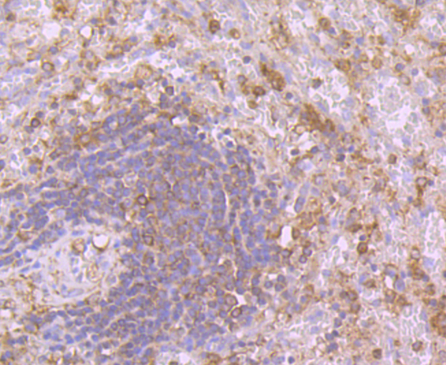 Immunohistochemical analysis of paraffin-embedded human spleen tissue using anti-Calpain 1 antibody. Counter stained with hematoxylin.