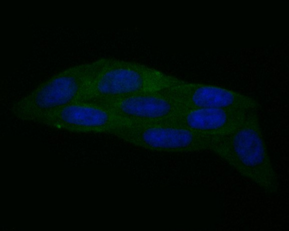 ICC staining Calpain 1(green) in SiHa cells. The nuclear counter stain is DAPI (blue). Cells were fixed in paraformaldehyde, permeabilised with 0.25% Triton X100/PBS.