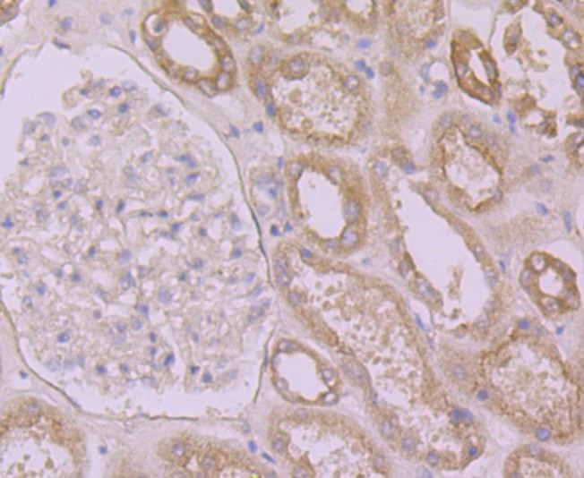 Immunohistochemical analysis of paraffin-embedded human kidney tissue using anti-Calpain 1 antibody. Counter stained with hematoxylin.