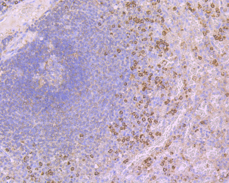 Immunohistochemical analysis of paraffin-embedded human spleen tissue using anti-Calpain 1 antibody. Counter stained with hematoxylin.