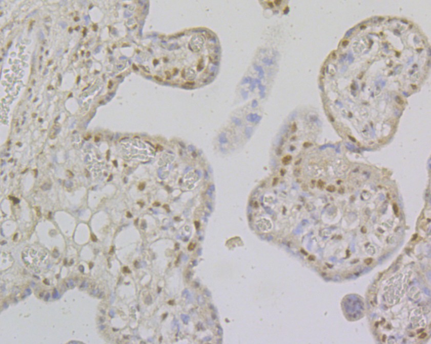 Immunohistochemical analysis of paraffin-embedded human placenta tissue using anti-MSH2 antibody. The section was pre-treated using heat mediated antigen retrieval with sodium citrate buffer (pH 6.0) for 20 minutes. The tissues were blocked in 5% BSA for 30 minutes at room temperature, washed with ddH2O and PBS, and then probed with the primary antibody (EM1801-04, 1/400)  for 30 minutes at room temperature. The detection was performed using an HRP conjugated compact polymer system. DAB was used as the chromogen. Tissues were counterstained with hematoxylin and mounted with DPX.