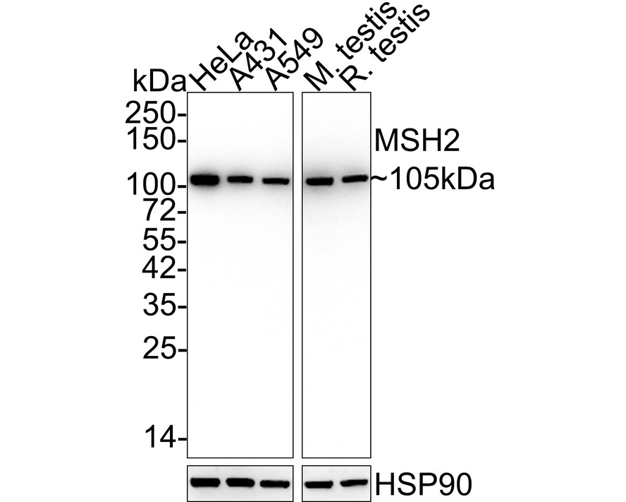 Western blot analysis of MSH2 on different lysates with Mouse anti-MSH2 antibody (EM1801-05) at 1/5,000 dilution.<br />
<br />
Lane 1: HeLa cell lysate (15 µg/Lane)<br />
Lane 2: A431 cell lysate (15 µg/Lane)<br />
Lane 3: A549 cell lysate (15 µg/Lane)<br />
Lane 4: Mouse testis tissue lysate (20 µg/Lane)<br />
Lane 5: Rat testis tissue lysate (20 µg/Lane)<br />
<br />
Predicted band size: 105 kDa<br />
Observed band size: 105 kDa<br />
<br />
Exposure time: 28 seconds;<br />
<br />
4-20% SDS-PAGE gel.<br />
<br />
Proteins were transferred to a PVDF membrane and blocked with 5% NFDM/TBST for 1 hour at room temperature. The primary antibody (EM1801-05) at 1/5,000 dilution was used in 5% NFDM/TBST at 4℃ overnight. Goat Anti-Mouse IgG - HRP Secondary Antibody (HA1006) at 1/50,000 dilution was used for 1 hour at room temperature.