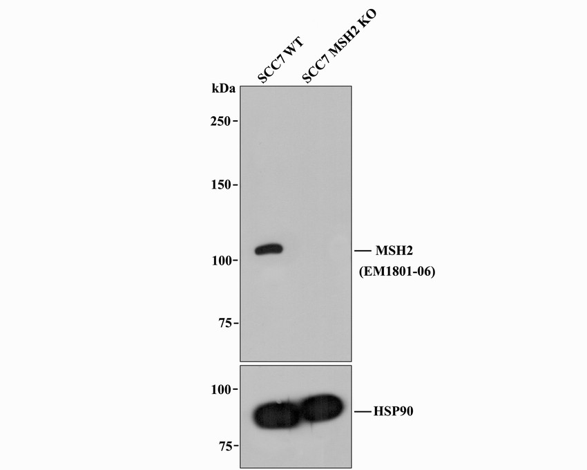 All lanes: Western blot analysis of MSH2 with anti-MSH2 antibody (EM1801-05) at 1:1,000 dilution.<br />
Lane 1: Wild-type SCC7 whole cell lysate.<br />
Lane 2: MSH2 knockout SCC7 whole cell lysate.<br />
<br />
EM1801-06 was shown to specifically react with MSH2 in Wild-type SCC7 cells. No band was observed when MSH2 knockout samples were tested. Wild-type and MSH2 knockout samples were subjected to SDS-PAGE. Proteins were transferred to a PVDF membrane and blocked with 5% NFDM in TBST for 1 hour at room temperature. The primary Anti-MSH2 antibody (EM1801-06, 1/1,000) and Anti-HSP90 antibody (ET1605-56, 1/10,000) were used in 5% BSA at room temperature for 2 hours. Goat Anti-Mouse IgG HRP Secondary Antibody (HA1006) at 1:20,000 dilution was used for 1 hour at room temperature.