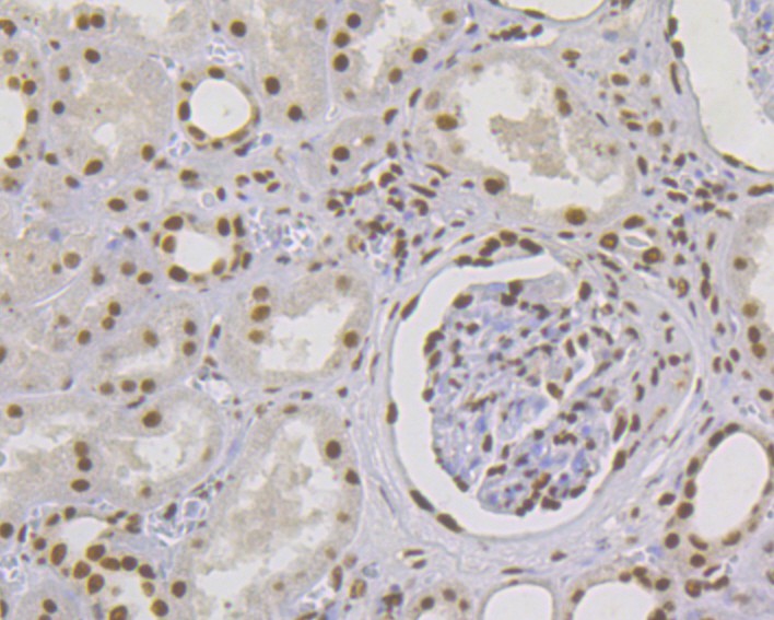 Immunohistochemical analysis of paraffin-embedded human kidney tissue using anti-MSH2 antibody. Counter stained with hematoxylin.  The section was pre-treated using heat mediated antigen retrieval with sodium citrate buffer (pH6) for 20 mins.