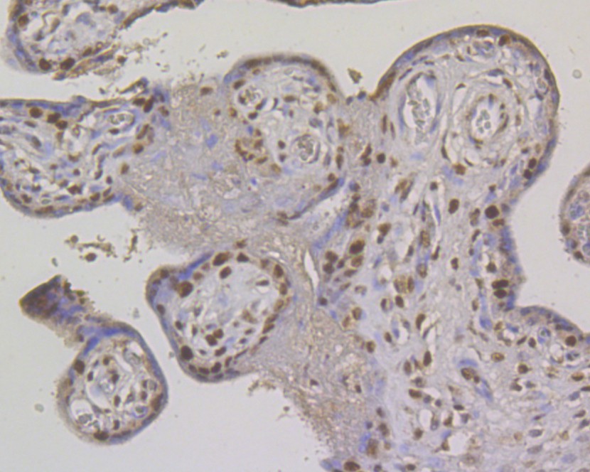 Immunohistochemical analysis of paraffin-embedded human placenta tissue using anti-MSH2 antibody. Counter stained with hematoxylin.  The section was pre-treated using heat mediated antigen retrieval with sodium citrate buffer (pH6) for 20 mins.