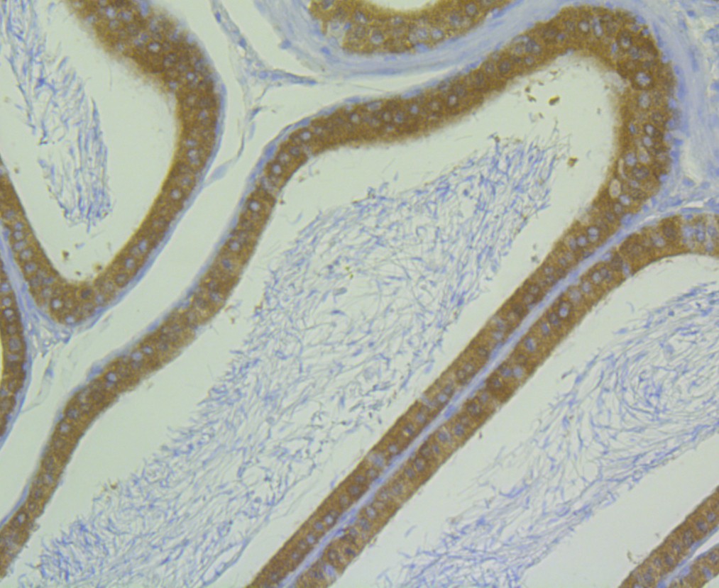 Immunohistochemical analysis of paraffin-embedded human pancreas tissue using anti-ALDH1A1 antibody. Counter stained with hematoxylin.