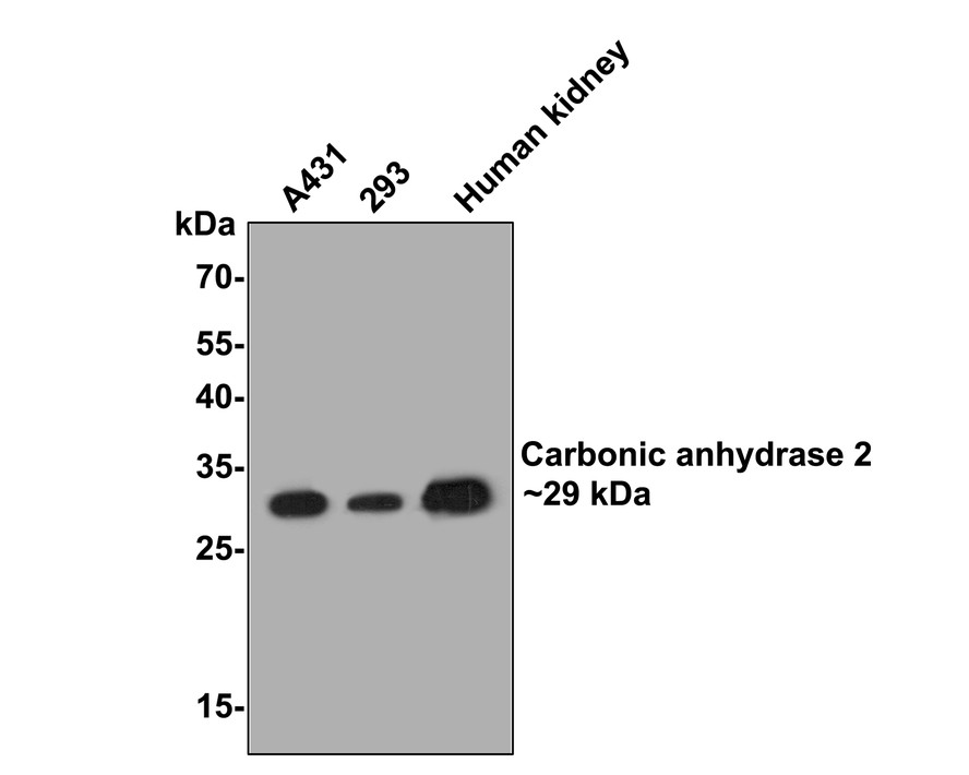 Western blot analysis of Carbonic anhydrase 2 on different lysates with Mouse anti-Carbonic anhydrase 2 antibody (EM1801-08) at 1/500 dilution.<br />
<br />
Lane 1: A431 cell lysate<br />
Lane 2: 293 cell lysate<br />
Lane 3: Human kidney tissue lysate(20 µg/Lane)<br />
<br />
Lysates/proteins at 10 µg/Lane.<br />
<br />
Predicted band size: 29 kDa<br />
Observed band size: 29 kDa<br />
<br />
Exposure time: 2 minutes;<br />
<br />
12% SDS-PAGE gel.<br />
<br />
Proteins were transferred to a PVDF membrane and blocked with 5% NFDM/TBST for 1 hour at room temperature. The primary antibody (EM1801-08) at 1/500 dilution was used in 5% NFDM/TBST at room temperature for 2 hours. Goat Anti-Mouse IgG - HRP Secondary Antibody (HA1006) at 1:20,000 dilution was used for 1 hour at room temperature.