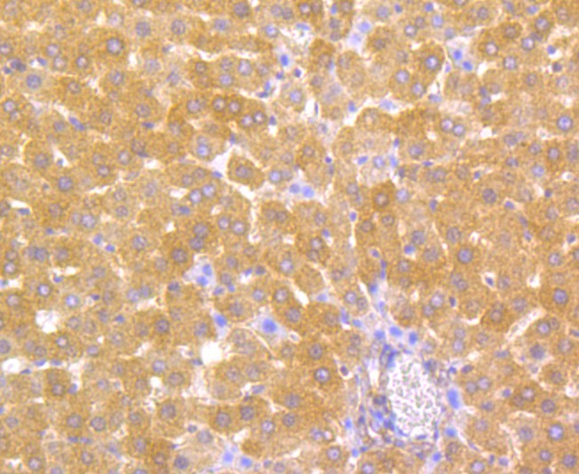 Immunohistochemical analysis of paraffin-embedded human colon tissue using anti-Carbonic anhydrase 2 antibody. The section was pre-treated using heat mediated antigen retrieval with Tris-EDTA buffer (pH 8.0-8.4) for 20 minutes.The tissues were blocked in 5% BSA for 30 minutes at room temperature, washed with ddH2O and PBS, and then probed with the antibody (EM1801-08) at 1/100 dilution, for 30 minutes at room temperature and detected using an HRP conjugated compact polymer system. DAB was used as the chrogen. Counter stained with hematoxylin and mounted with DPX.