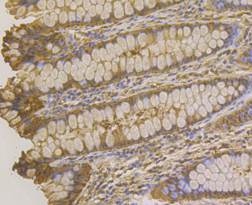 Immunohistochemical analysis of paraffin-embedded human kidney tissue using anti-Carbonic anhydrase 2 antibody. The section was pre-treated using heat mediated antigen retrieval with Tris-EDTA buffer (pH 8.0-8.4) for 20 minutes.The tissues were blocked in 5% BSA for 30 minutes at room temperature, washed with ddH2O and PBS, and then probed with the antibody (EM1801-08) at 1/100 dilution, for 30 minutes at room temperature and detected using an HRP conjugated compact polymer system. DAB was used as the chrogen. Counter stained with hematoxylin and mounted with DPX.