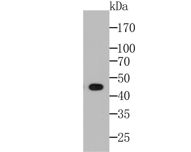 Western blot analysis of HLA Class 1 ABC on Hela lysate. Proteins were transferred to a nitrocellulose membrane and blocked with 5% BSA in PBS for 1 hour at room temperature. The primary antibody was used at a 1:500 dilution in 5% BSA at room temperature for 2 hours, washed in TBST, and probed with an HRP-conjugated secondary antibody for 1 hour at room temperature. Chemiluminescent detection was performed using SuperSignal ECL Western Blotting Substrate (Product # K1801).