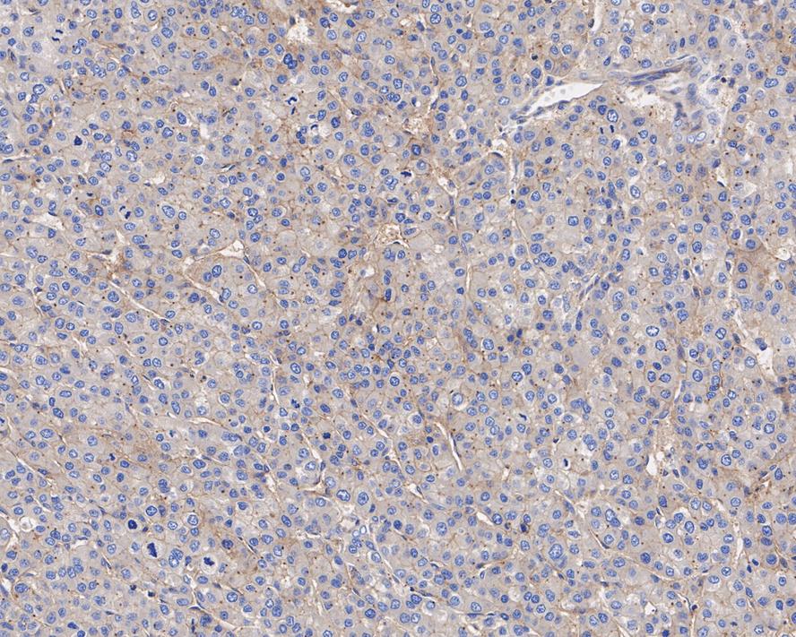 Immunohistochemical analysis of paraffin-embedded rat uterus tissue using anti-HLA Class 1 ABC antibody. The section was pre-treated using heat mediated antigen retrieval with Tris-EDTA buffer (pH 8.0-8.4) for 20 minutes.The tissues were blocked in 5% BSA for 30 minutes at room temperature, washed with ddH2O and PBS, and then probed with the antibody (EM1801-10) at 1/200 dilution, for 30 minutes at room temperature and detected using an HRP conjugated compact polymer system. DAB was used as the chrogen. Counter stained with hematoxylin and mounted with DPX.