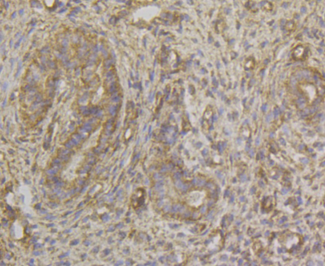 Immunohistochemical analysis of paraffin-embedded human kidney tissue using anti-HLA Class 1 ABC antibody. The section was pre-treated using heat mediated antigen retrieval with Tris-EDTA buffer (pH 8.0-8.4) for 20 minutes.The tissues were blocked in 5% BSA for 30 minutes at room temperature, washed with ddH2O and PBS, and then probed with the antibody (EM1801-10) at 1/200 dilution, for 30 minutes at room temperature and detected using an HRP conjugated compact polymer system. DAB was used as the chrogen. Counter stained with hematoxylin and mounted with DPX.