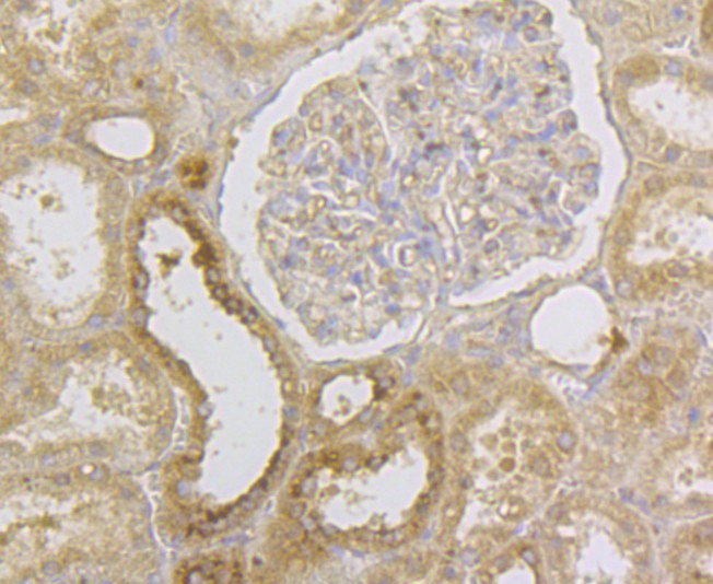 Immunohistochemical analysis of paraffin-embedded mouse testis tissue using anti-HLA Class 1 ABC antibody. The section was pre-treated using heat mediated antigen retrieval with Tris-EDTA buffer (pH 8.0-8.4) for 20 minutes.The tissues were blocked in 5% BSA for 30 minutes at room temperature, washed with ddH2O and PBS, and then probed with the antibody (EM1801-10) at 1/200 dilution, for 30 minutes at room temperature and detected using an HRP conjugated compact polymer system. DAB was used as the chrogen. Counter stained with hematoxylin and mounted with DPX.