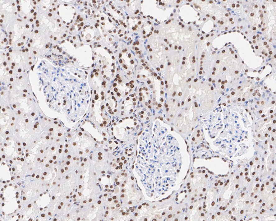 Immunohistochemical analysis of paraffin-embedded human kidney tissue with Mouse anti-APE1 antibody (EM1801-12) at 1/1,000 dilution.<br />
<br />
The section was pre-treated using heat mediated antigen retrieval with sodium citrate buffer (pH 6.0) for 2 minutes. The tissues were blocked in 1% BSA for 20 minutes at room temperature, washed with ddH2O and PBS, and then probed with the primary antibody (EM1801-12) at 1/1,000 dilution for 1 hour at room temperature. The detection was performed using an HRP conjugated compact polymer system. DAB was used as the chromogen. Tissues were counterstained with hematoxylin and mounted with DPX.