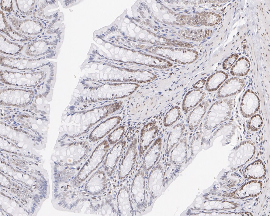 Immunohistochemical analysis of paraffin-embedded rat colon tissue with Mouse anti-APE1 antibody (EM1801-12) at 1/1,000 dilution.<br />
<br />
The section was pre-treated using heat mediated antigen retrieval with sodium citrate buffer (pH 6.0) for 2 minutes. The tissues were blocked in 1% BSA for 20 minutes at room temperature, washed with ddH2O and PBS, and then probed with the primary antibody (EM1801-12) at 1/1,000 dilution for 1 hour at room temperature. The detection was performed using an HRP conjugated compact polymer system. DAB was used as the chromogen. Tissues were counterstained with hematoxylin and mounted with DPX.