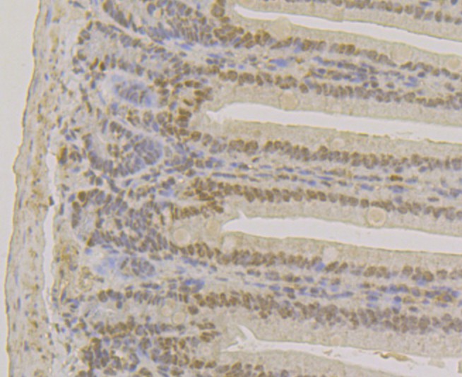 Immunohistochemical analysis of paraffin-embedded mouse colon tissue using anti-APE1 antibody. The section was pre-treated using heat mediated antigen retrieval with sodium citrate buffer (pH 6.0) for 20 minutes. The tissues were blocked in 5% BSA for 30 minutes at room temperature, washed with ddH2O and PBS, and then probed with the antibody (EM1801-12) at 1/200 dilution, for 30 minutes at room temperature and detected using an HRP conjugated compact polymer system. DAB was used as the chrogen. Counter stained with hematoxylin and mounted with DPX.