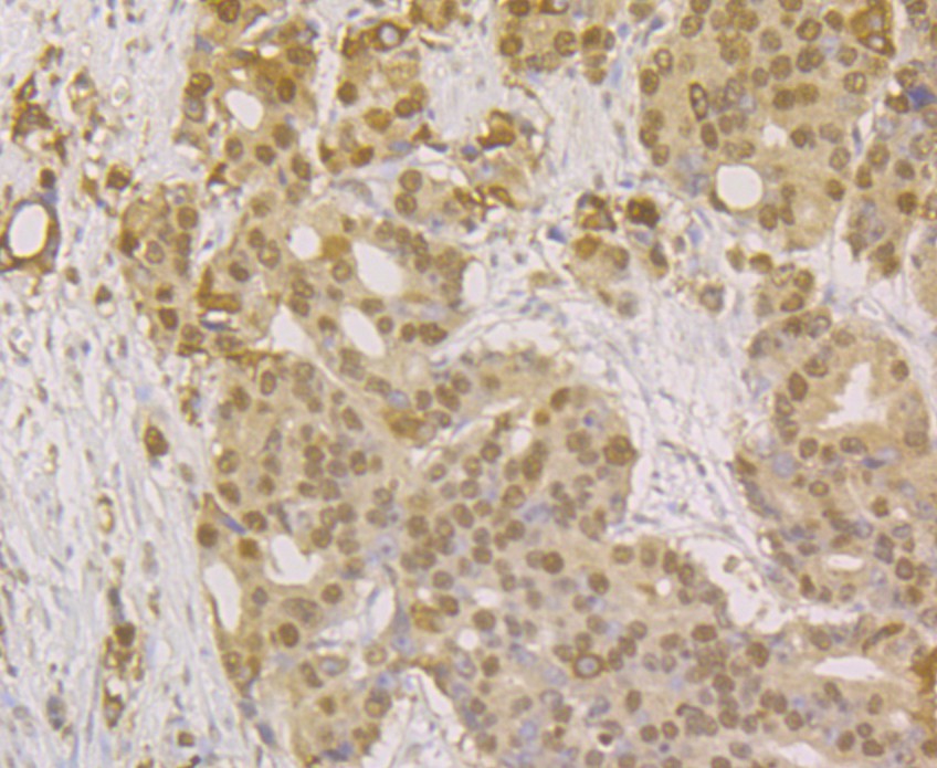 Immunohistochemical analysis of paraffin-embedded human kidney tissue using anti-APE1 antibody. The section was pre-treated using heat mediated antigen retrieval with sodium citrate buffer (pH 6.0) for 20 minutes. The tissues were blocked in 5% BSA for 30 minutes at room temperature, washed with ddH2O and PBS, and then probed with the antibody (EM1801-13) at 1/200 dilution, for 30 minutes at room temperature and detected using an HRP conjugated compact polymer system. DAB was used as the chrogen. Counter stained with hematoxylin and mounted with DPX.