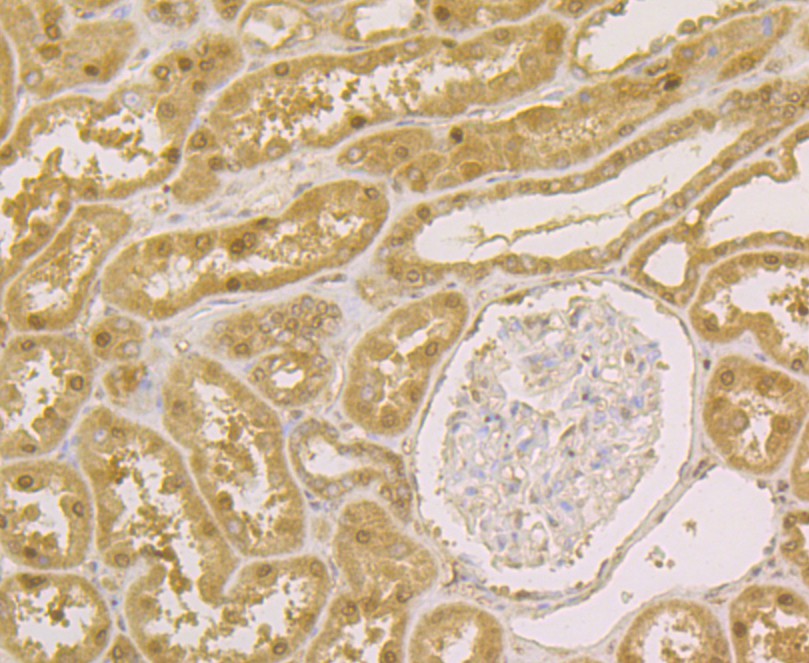 Immunohistochemical analysis of paraffin-embedded mouse colon tissue using anti-APE1 antibody. The section was pre-treated using heat mediated antigen retrieval with sodium citrate buffer (pH 6.0) for 20 minutes. The tissues were blocked in 5% BSA for 30 minutes at room temperature, washed with ddH2O and PBS, and then probed with the antibody (EM1801-13) at 1/200 dilution, for 30 minutes at room temperature and detected using an HRP conjugated compact polymer system. DAB was used as the chrogen. Counter stained with hematoxylin and mounted with DPX.