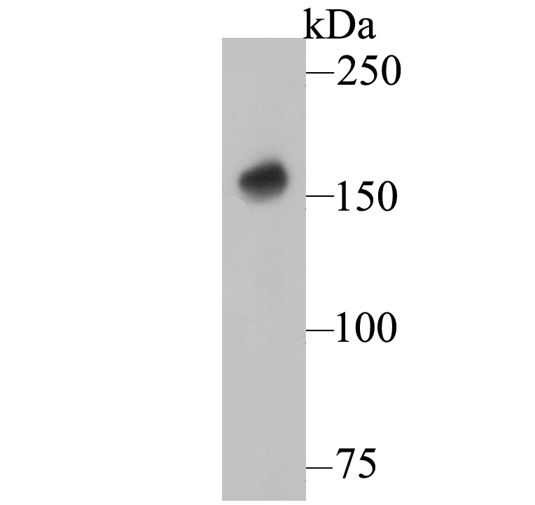Western blot analysis of DAP Kinase 1 on rat brain tissue lysate. Proteins were transferred to a PVDF membrane and blocked with 5% BSA in PBS for 1 hour at room temperature. The primary antibody was used at a 1:500 dilution in 5% BSA at room temperature for 2 hours. Goat Anti-Mouse IgG - HRP Secondary Antibody (HA1006) at 1:5,000 dilution was used for 1 hour at room temperature.