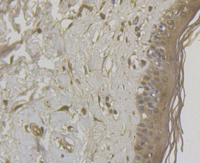 Immunohistochemical analysis of paraffin-embedded human skin tissue using anti-DAP Kinase 1 antibody. The section was pre-treated using heat mediated antigen retrieval with Tris-EDTA buffer (pH 8.0-8.4) for 20 minutes.The tissues were blocked in 5% BSA for 30 minutes at room temperature, washed with ddH2O and PBS, and then probed with the antibody (EM1801-15) at 1/200 dilution, for 30 minutes at room temperature and detected using an HRP conjugated compact polymer system. DAB was used as the chrogen. Counter stained with hematoxylin and mounted with DPX.