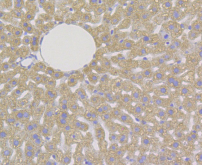 Immunohistochemical analysis of paraffin-embedded mouse liver tissue using anti-DAP Kinase 1 antibody. The section was pre-treated using heat mediated antigen retrieval with Tris-EDTA buffer (pH 8.0-8.4) for 20 minutes.The tissues were blocked in 5% BSA for 30 minutes at room temperature, washed with ddH2O and PBS, and then probed with the antibody (EM1801-15) at 1/50 dilution, for 30 minutes at room temperature and detected using an HRP conjugated compact polymer system. DAB was used as the chrogen. Counter stained with hematoxylin and mounted with DPX.