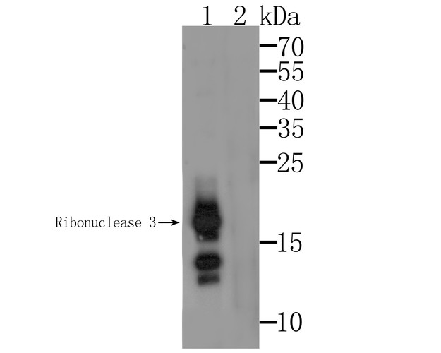 Western blot analysis of Ribonuclease 3 on U937 cell lysate. Proteins were transferred to a PVDF membrane and blocked with 5% BSA in PBS for 1 hour at room temperature. The primary antibody was used at a 1:500 dilution in 5% BSA at room temperature for 2 hours. Goat Anti-Mouse IgG - HRP Secondary Antibody (HA1006) at 1:5,000 dilution was used for 1 hour at room temperature.<br />
<br />
Lane 1: Anti-Ribonuclease 3 Antibody, (1:500).<br />
Lane 2: Anti-Ribonuclease 3 Antibody, (1:500), preincubated with the immunization protein.
