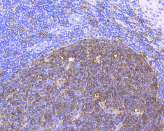 Immunohistochemical analysis of paraffin-embedded human tonsil tissue using anti-Stathmin 1 antibody. The section was pre-treated using heat mediated antigen retrieval with Tris-EDTA buffer (pH 8.0-8.4) for 20 minutes.The tissues were blocked in 5% BSA for 30 minutes at room temperature, washed with ddH2O and PBS, and then probed with the antibody (EM1801-19) at 1/200 dilution, for 30 minutes at room temperature and detected using an HRP conjugated compact polymer system. DAB was used as the chrogen. Counter stained with hematoxylin and mounted with DPX.