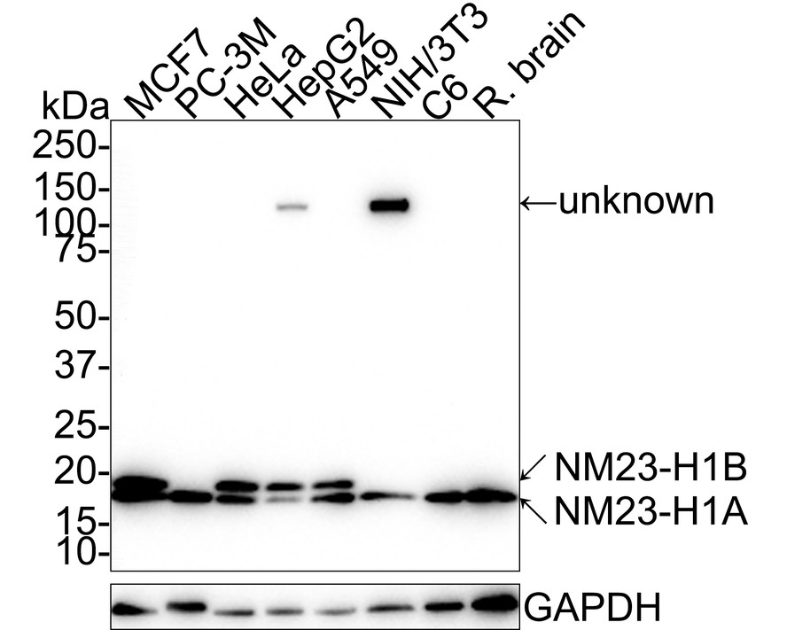 Western blot analysis of NM23 on PC-3M cell lysates with Mouse anti-NM23 antibody (EM1801-20) at 1/2,000 dilution.<br />
<br />
Lysates/proteins at 10 µg/Lane.<br />
<br />
Predicted band size: 17 kDa<br />
Observed band size: 17/19 kDa<br />
<br />
Exposure time: 30 seconds;<br />
<br />
15% SDS-PAGE gel.<br />
<br />
Proteins were transferred to a PVDF membrane and blocked with 5% NFDM/TBST for 1 hour at room temperature. The primary antibody (EM1801-20) at 1/2,000 dilution was used in 5% NFDM/TBST at room temperature for 2 hours. Goat Anti-Mouse IgG - HRP Secondary Antibody (HA1006) at 1:100,000 dilution was used for 1 hour at room temperature.