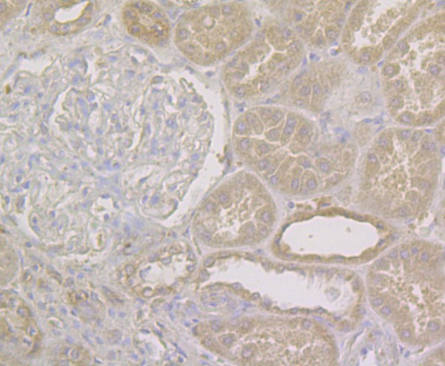 Immunohistochemical analysis of paraffin-embedded human kidney tissue using anti-NQO1 antibody. The section was pre-treated using heat mediated antigen retrieval with sodium citrate buffer (pH 6.0) for 20 minutes. The tissues were blocked in 5% BSA for 30 minutes at room temperature, washed with ddH2O and PBS, and then probed with the antibody (EM1801-21) at 1/50 dilution, for 30 minutes at room temperature and detected using an HRP conjugated compact polymer system. DAB was used as the chromogen. Counter stained with hematoxylin and mounted with DPX.