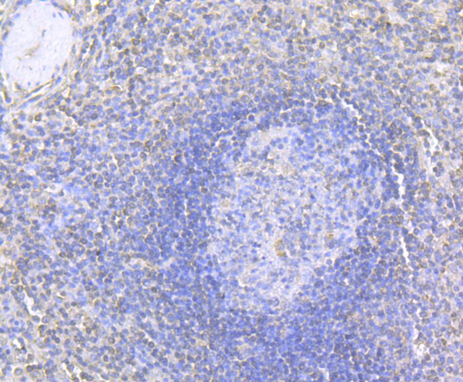Immunohistochemical analysis of paraffin-embedded human tonsil tissue using anti-MMP9 antibody. The section was pre-treated using heat mediated antigen retrieval with Tris-EDTA buffer (pH 8.0-8.4) for 20 minutes.The tissues were blocked in 5% BSA for 30 minutes at room temperature, washed with ddH2O and PBS, and then probed with the antibody (EM1801-22) at 1/50 dilution, for 30 minutes at room temperature and detected using an HRP conjugated compact polymer system. DAB was used as the chrogen. Counter stained with hematoxylin and mounted with DPX.