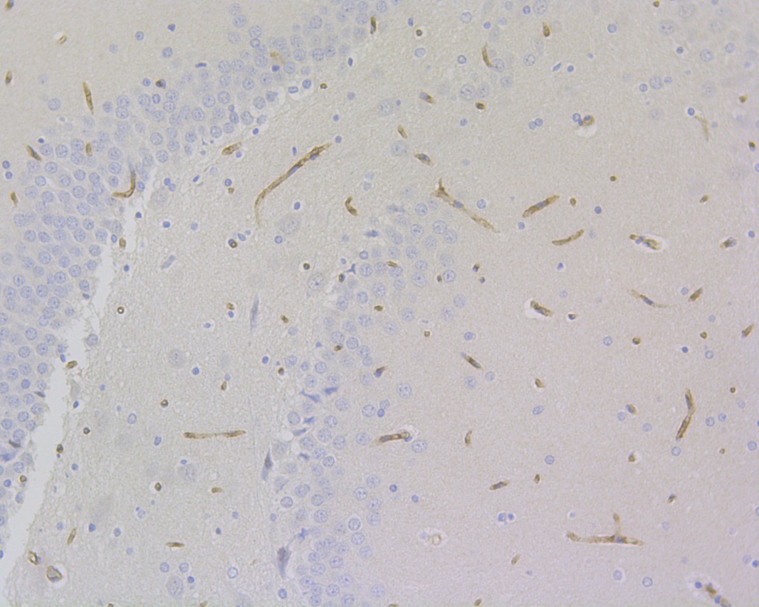 Immunohistochemical analysis of paraffin-embedded rat brain tissue using anti-CD34 antibody. The section was pre-treated using heat mediated antigen retrieval with Tris-EDTA buffer (pH 9.0) for 20 minutes.The tissues were blocked in 1% BSA for 30 minutes at room temperature, washed with ddH2O and PBS, and then probed with the primary antibody (EM1901-01, 1/200) for 30 minutes at room temperature. The detection was performed using an HRP conjugated compact polymer system. DAB was used as the chromogen. Tissues were counterstained with hematoxylin and mounted with DPX.