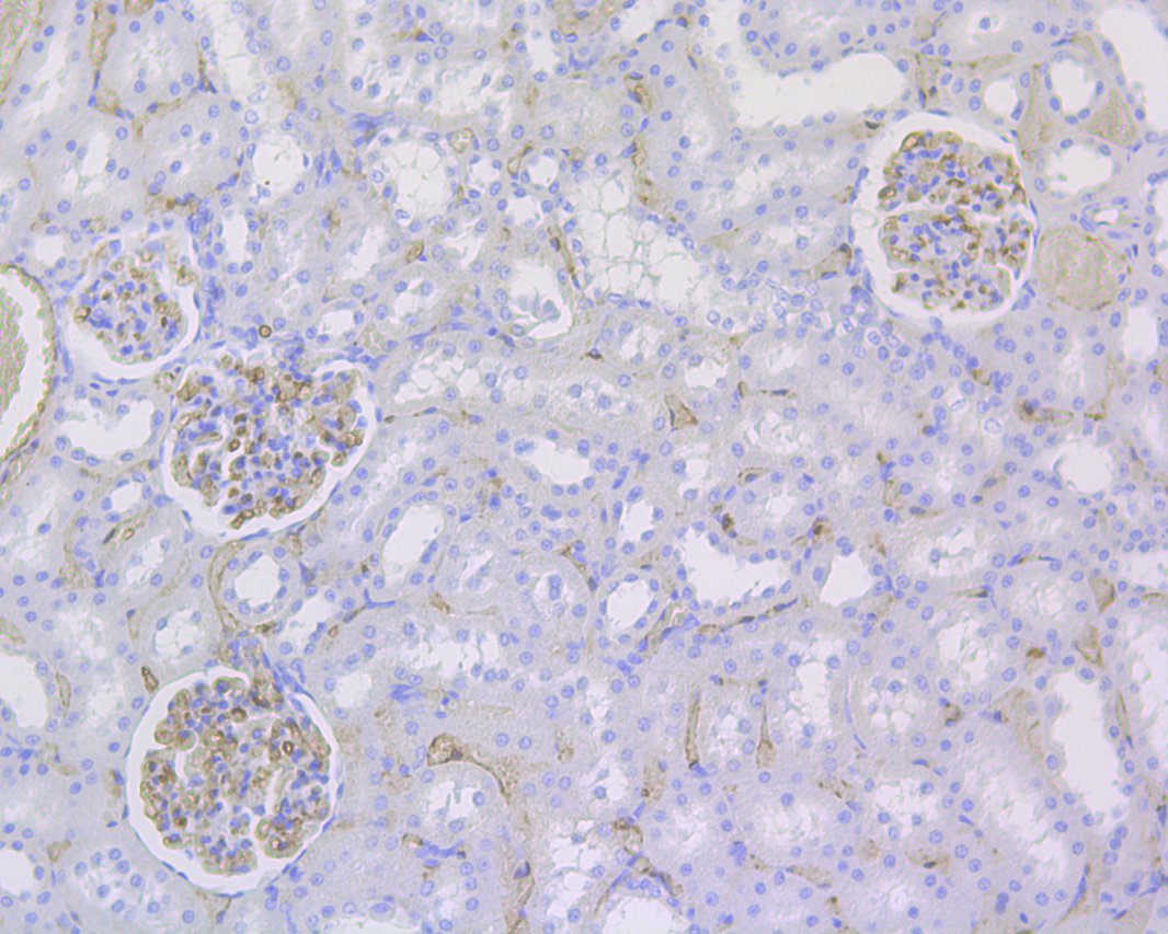 Immunohistochemical analysis of paraffin-embedded rat kidney tissue using anti-CD34 antibody. The section was pre-treated using heat mediated antigen retrieval with Tris-EDTA buffer (pH 9.0) for 20 minutes.The tissues were blocked in 1% BSA for 30 minutes at room temperature, washed with ddH2O and PBS, and then probed with the primary antibody (EM1901-01, 1/200) for 30 minutes at room temperature. The detection was performed using an HRP conjugated compact polymer system. DAB was used as the chromogen. Tissues were counterstained with hematoxylin and mounted with DPX.