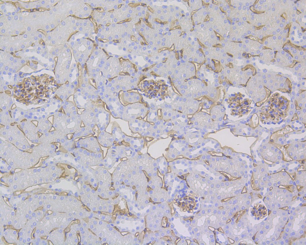 Immunohistochemical analysis of paraffin-embedded mouse kidney tissue using anti-CD34 antibody. The section was pre-treated using heat mediated antigen retrieval with Tris-EDTA buffer (pH 9.0) for 20 minutes.The tissues were blocked in 1% BSA for 30 minutes at room temperature, washed with ddH2O and PBS, and then probed with the primary antibody (EM1901-01, 1/200) for 30 minutes at room temperature. The detection was performed using an HRP conjugated compact polymer system. DAB was used as the chromogen. Tissues were counterstained with hematoxylin and mounted with DPX.