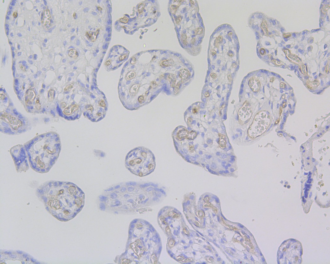 Immunohistochemical analysis of paraffin-embedded human placenta tissue using anti-CD34 antibody. The section was pre-treated using heat mediated antigen retrieval with Tris-EDTA buffer (pH 9.0) for 20 minutes.The tissues were blocked in 1% BSA for 30 minutes at room temperature, washed with ddH2O and PBS, and then probed with the primary antibody (EM1901-01, 1/200) for 30 minutes at room temperature. The detection was performed using an HRP conjugated compact polymer system. DAB was used as the chromogen. Tissues were counterstained with hematoxylin and mounted with DPX.