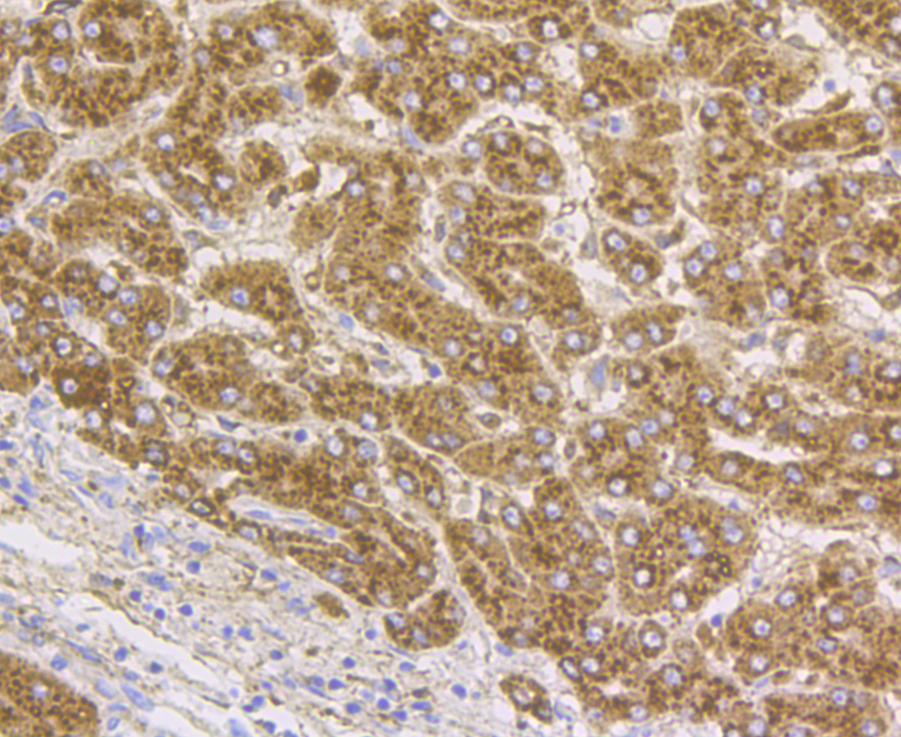 Immunohistochemical analysis of paraffin-embedded human liver tissue using anti-Cathepsin D antibody. The section was pre-treated using heat mediated antigen retrieval with Tris-EDTA buffer (pH 8.0-8.4) for 20 minutes.The tissues were blocked in 5% BSA for 30 minutes at room temperature, washed with ddH2O and PBS, and then probed with the antibody (EM1901-03) at 1/200 dilution, for 30 minutes at room temperature and detected using an HRP conjugated compact polymer system. DAB was used as the chromogen. Counter stained with hematoxylin and mounted with DPX.