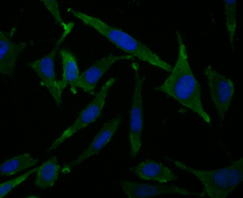 ICC staining of Hip1 in SH-SY5Y cells (green). Formalin fixed cells were permeabilized with 0.1% Triton X-100 in TBS for 10 minutes at room temperature and blocked with 1% Blocker BSA for 15 minutes at room temperature. Cells were probed with the primary antibody (EM1901-04, 1/50 dilution)  for 1 hour at room temperature, washed with PBS. Alexa Fluor®488 Goat anti-Rabbit IgG was used as the secondary antibody at 1/100 dilution. The nuclear counter stain is DAPI (blue).