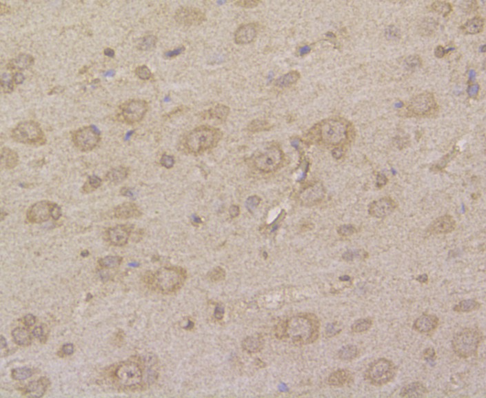 Immunohistochemical analysis of paraffin-embedded rat brain tissue using anti-Hip1 antibody. The section was pre-treated using heat mediated antigen retrieval with Tris-EDTA buffer (pH 8.0-8.4) for 20 minutes.The tissues were blocked in 5% BSA for 30 minutes at room temperature, washed with ddH2O and PBS, and then probed with the primary antibody (EM1901-04, 1/200 dilution) for 30 minutes at room temperature and detected using an HRP conjugated compact polymer system. DAB was used as the chromogen. Counter stained with hematoxylin and mounted with DPX.