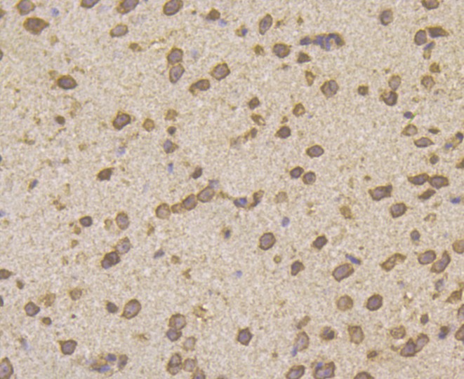 Immunohistochemical analysis of paraffin-embedded mouse brain tissue using anti-Hip1 antibody. The section was pre-treated using heat mediated antigen retrieval with Tris-EDTA buffer (pH 8.0-8.4) for 20 minutes.The tissues were blocked in 5% BSA for 30 minutes at room temperature, washed with ddH2O and PBS, and then probed with primary antibody (EM1901-04, 1/200 dilution) for 30 minutes at room temperature and detected using an HRP conjugated compact polymer system. DAB was used as the chromogen. Counter stained with hematoxylin and mounted with DPX.