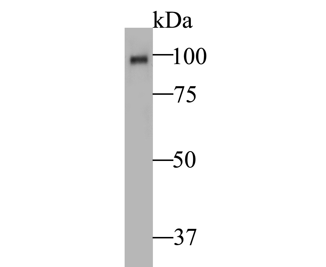 Western blot analysis of Auxin response factor on tea leafbud lysates. Proteins were transferred to a PVDF membrane and blocked with 5% BSA in PBS for 1 hour at room temperature. The primary antibody was used at a 1:1,000 dilution in 5% BSA at room temperature for 2 hours. Goat Anti-Mouse IgG - HRP Secondary Antibody (HA1006) at 1:5,000 dilution was used for 1 hour at room temperature.