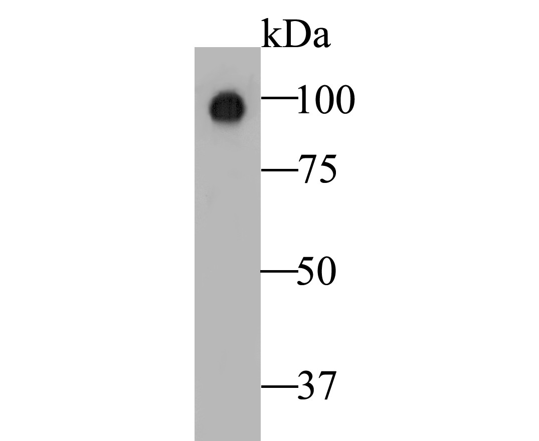 Western blot analysis of Auxin response factor on tea leafbud lysates. Proteins were transferred to a PVDF membrane and blocked with 5% BSA in PBS for 1 hour at room temperature. The primary antibody was used at a 1:1,000 dilution in 5% BSA at room temperature for 2 hours. Goat Anti-Rabbit IgG - HRP Secondary Antibody (HA1001) at 1:5,000 dilution was used for 1 hour at room temperature.