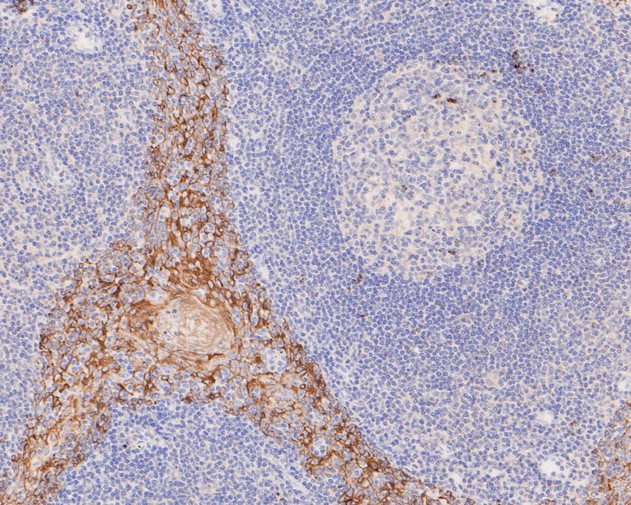 Immunohistochemical analysis of paraffin-embedded human tonsil tissue using anti-Cytokeratin 5+6 antibody. The section was pre-treated using heat mediated antigen retrieval with Tris-EDTA buffer (pH 8.0-8.4) for 20 minutes.The tissues were blocked in 5% BSA for 30 minutes at room temperature, washed with ddH2O and PBS, and then probed with the primary antibody (EM1901-07, 1/200) for 30 minutes at room temperature. The detection was performed using an HRP conjugated compact polymer system. DAB was used as the chromogen. Tissues were counterstained with hematoxylin and mounted with DPX.