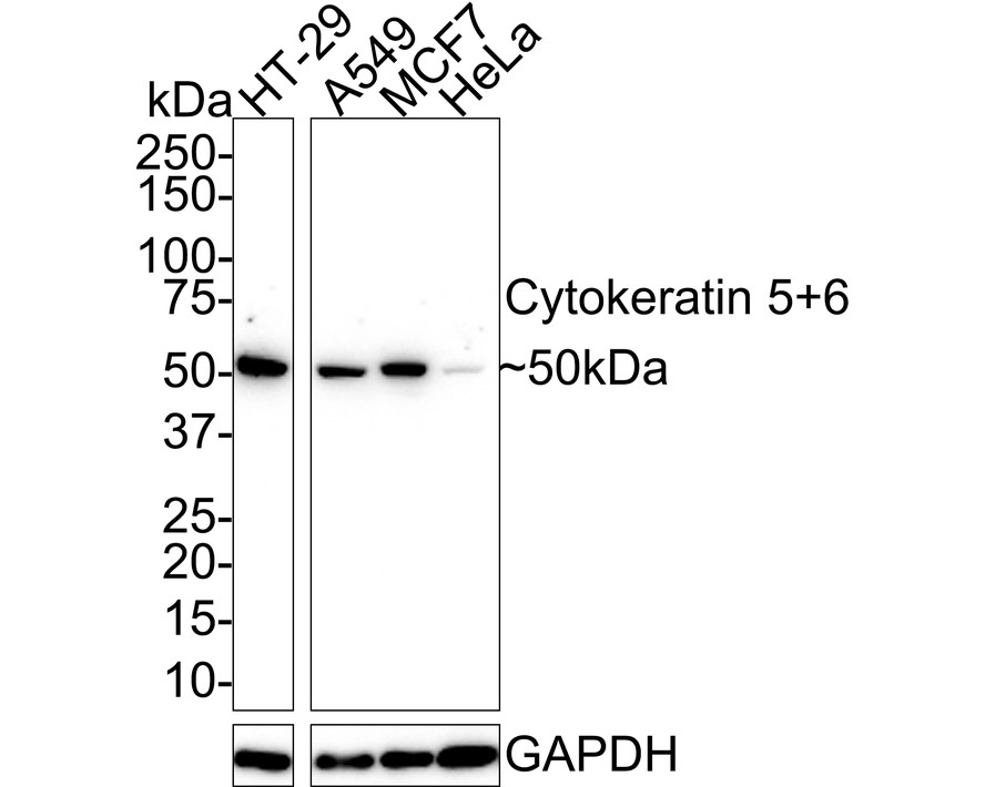 Western blot analysis of Cytokeratin 5+6 on HT-29 cell lysates. Proteins were transferred to a PVDF membrane and blocked with 5% BSA in PBS for 1 hour at room temperature. The primary antibody (EM1901-08, 1/100) was used in 5% BSA at room temperature for 2 hours. Goat Anti-Mouse IgG - HRP Secondary Antibody (HA1006) at 1:5,000 dilution was used for 1 hour at room temperature.