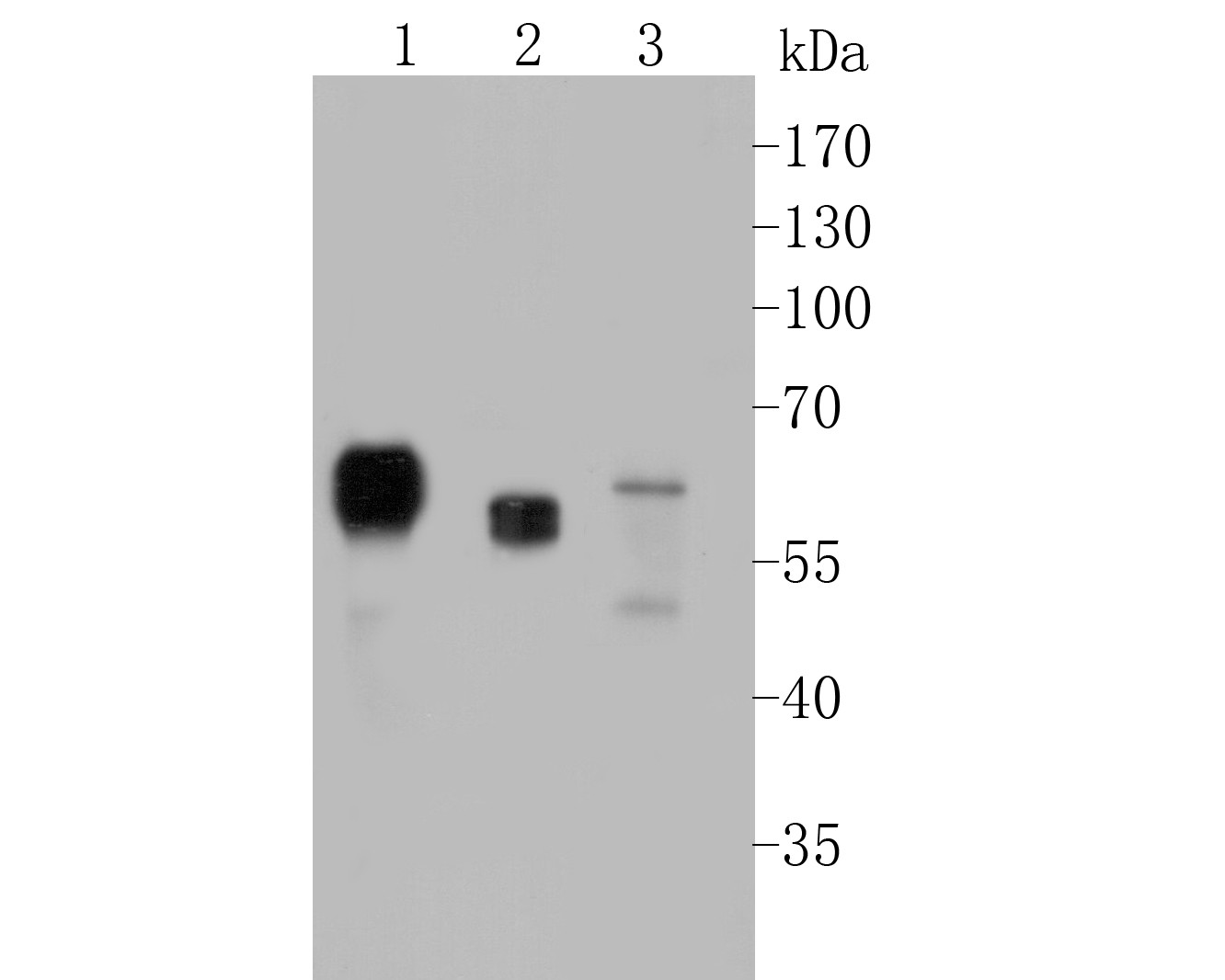 Western blot analysis of SERPINC1 on different lysates. Proteins were transferred to a PVDF membrane and blocked with 5% BSA in PBS for 1 hour at room temperature. The primary antibody (EM1901-11, 1/500) was used in 5% BSA at room temperature for 2 hours. Goat Anti-Mouse IgG - HRP Secondary Antibody (HA1006) at 1:5,000 dilution was used for 1 hour at room temperature.<br />
Positive control: <br />
Lane 1: HepG2 cell lysate<br />
Lane 2: SiHa cell lysate<br />
Lane 3: U937 cell lysate