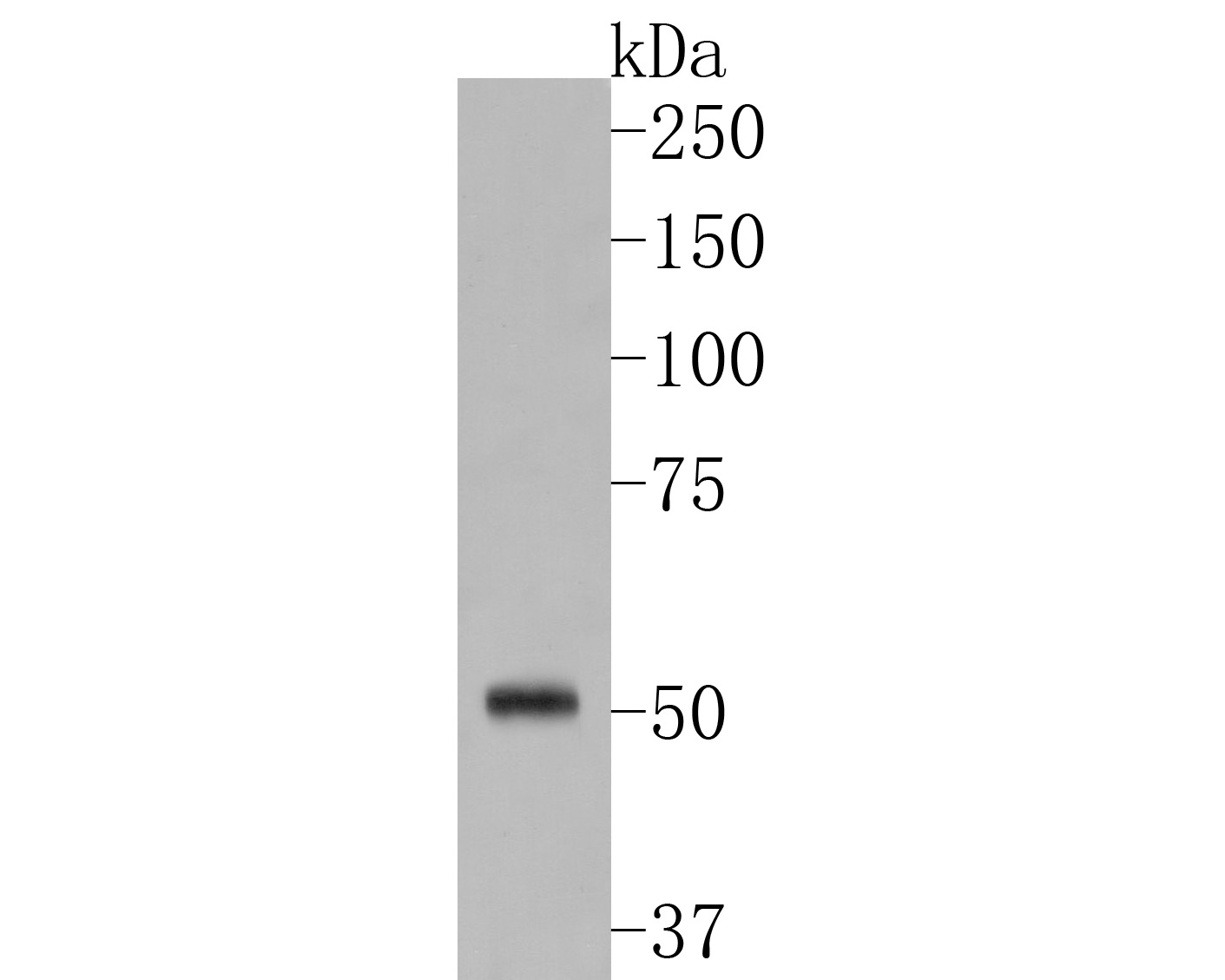 Western blot analysis of SERPINC1 on zebrafish tissue lysates. Proteins were transferred to a PVDF membrane and blocked with 5% BSA in PBS for 1 hour at room temperature. The primary antibody (EM1901-11, 1/500) was used in 5% BSA at room temperature for 2 hours. Goat Anti-Rabbit IgG - HRP Secondary Antibody (HA1001) at 1:5,000 dilution was used for 1 hour at room temperature.