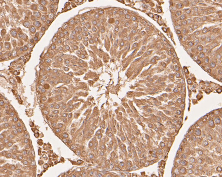 Immunohistochemical analysis of paraffin-embedded rat testis tissue using anti-SERPINC1 antibody. The section was pre-treated using heat mediated antigen retrieval with Tris-EDTA buffer (pH 8.0-8.4) for 20 minutes.The tissues were blocked in 5% BSA for 30 minutes at room temperature, washed with ddH2O and PBS, and then probed with the primary antibody (EM1901-11, 1/50) for 30 minutes at room temperature. The detection was performed using an HRP conjugated compact polymer system. DAB was used as the chromogen. Tissues were counterstained with hematoxylin and mounted with DPX.