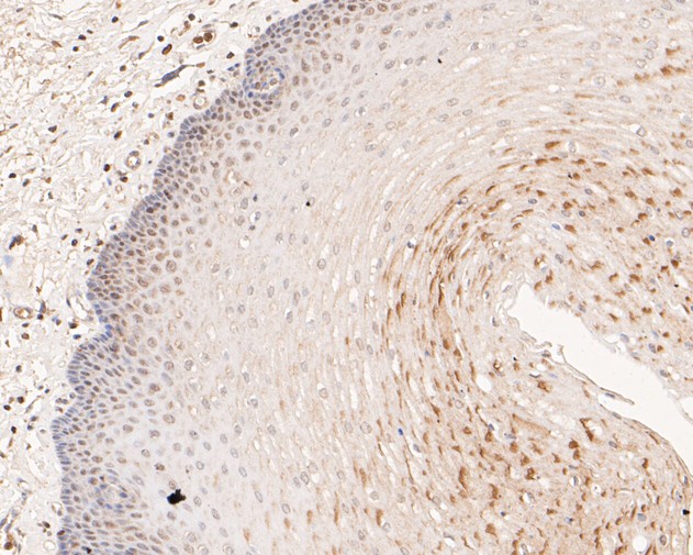 Immunohistochemical analysis of paraffin-embedded human esophagus tissue using anti-MCM7 antibody. The section was pre-treated using heat mediated antigen retrieval with sodium citrate buffer (pH 6.0) for 20 minutes. The tissues were blocked in 5% BSA for 30 minutes at room temperature, washed with ddH2O and PBS, and then probed with the primary antibody (EM1901-12, 1/100)  for 30 minutes at room temperature. The detection was performed using an HRP conjugated compact polymer system. DAB was used as the chromogen. Tissues were counterstained with hematoxylin and mounted with DPX.